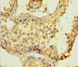 SUPT16H / FACTP140 Antibody - Immunohistochemistry of paraffin-embedded human testis tissue at dilution of 1:100