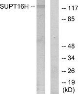 SUPT16H / FACTP140 Antibody - Western blot analysis of extracts from HepG2 cells, using SUPT16H antibody.