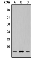 SUPT4H1 / SPT4 Antibody - Western blot analysis of SUPT4H expression in HeLa (A); NS-1 (B); PC12 (C) whole cell lysates.