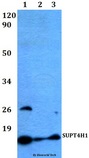 SUPT4H1 / SPT4 Antibody - Western blot of SUPT4H1 antibody at 1:500 dilution. Lane 1: HeLa whole cell lysate. Lane 2: sp2/0 whole cell lysate. Lane 3: PC12 whole cell lysate.