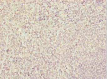 SUPT4H1 / SPT4 Antibody - Immunohistochemistry of paraffin-embedded human tonsil tissue at dilution 1:100