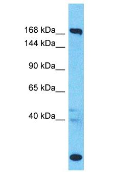 SUPT6H / SPT6 Antibody - SUPT6H / SPT6 antibody Western Blot of Colorectal Tumor. Antibody dilution: 1 ug/ml.  This image was taken for the unconjugated form of this product. Other forms have not been tested.