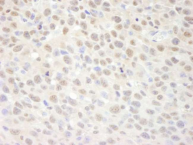 SUPT6H / SPT6 Antibody - Detection of Mouse SUPT6H by Immunohistochemistry. Sample: FFPE section of mouse squamous cell carcinoma. Antibody: Affinity purified rabbit anti-SUPT6H used at a dilution of 1:500.