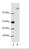 SUPT6H / SPT6 Antibody - A: Marker, B: Jurkat Cell Lysate.  This image was taken for the unconjugated form of this product. Other forms have not been tested.