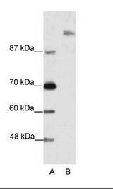 SUPT6H / SPT6 Antibody - A: Marker, B: Jurkat Cell Lysate.  This image was taken for the unconjugated form of this product. Other forms have not been tested.