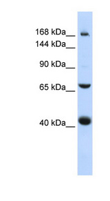 SUR2 / ABCC9 Antibody - ABCC9 antibody Western blot of 721_B cell lysate. This image was taken for the unconjugated form of this product. Other forms have not been tested.