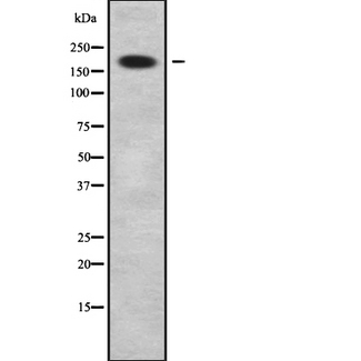 SUR2 / ABCC9 Antibody - Western blot analysis of ABCC9 using HeLa whole cells lysates