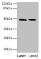surA Antibody - Western blot All lanes: Chaperone SurA antibody at 12µg/ml Lane 1: 293T whole cell lysate Lane 2: DH5&alpha; whole cell lysate Secondary Goat polyclonal to rabbit IgG at 1/10000 dilution Predicted band size: 47 kDa Observed band size: 47 kDa