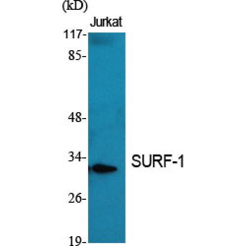 SURF1 Antibody - Western blot of SURF-1 antibody