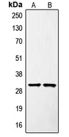 SURF1 Antibody - Western blot analysis of SURF1 expression in Jurkat (A); mouse liver (B) whole cell lysates.
