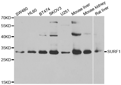 SURF1 Antibody - Western blot analysis of extracts of various cell lines.