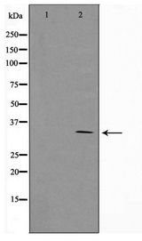 SURF1 Antibody - Western blot of Jurkat cell lysate using SURF1 Antibody