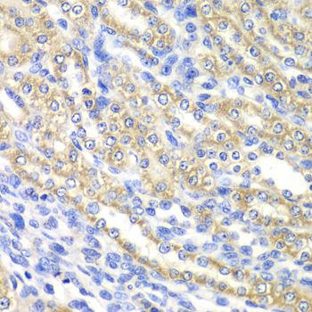 SURF1 Antibody - Immunohistochemistry of paraffin-embedded rat kidney using SURF1 antibody at dilution of 1:100 (40x lens).