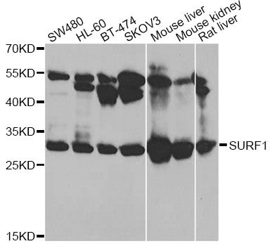 SURF1 Antibody - Western blot analysis of extracts of various cell lines, using SURF1 antibody at 1:1000 dilution. The secondary antibody used was an HRP Goat Anti-Rabbit IgG (H+L) at 1:10000 dilution. Lysates were loaded 25ug per lane and 3% nonfat dry milk in TBST was used for blocking. An ECL Kit was used for detection and the exposure time was 3s.