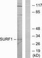 SURF1 Antibody - Western blot analysis of extracts from Jurkat cells, using SURF1 antibody.
