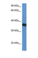 SURF1 Antibody - SURF1 antibody Western blot of HepG2 Cell lysate. Antibody concentration 1 ug/ml.  This image was taken for the unconjugated form of this product. Other forms have not been tested.