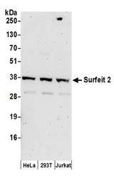 SURF2 / SURF-2 Antibody - Detection of human Surfeit 2 by western blot. Samples: Whole cell lysate (50 µg) from HeLa, HEK293T, and Jurkat cells prepared using NETN lysis buffer. Antibodies: Affinity purified rabbit anti-Surfeit 2 antibody used for WB at 0.1 µg/ml. Detection: Chemiluminescence with an exposure time of 3 minutes.