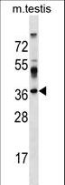 SURF4 Antibody - SURF4 Antibody western blot of mouse testis tissue lysates (35 ug/lane). The SURF4 antibody detected the SURF4 protein (arrow).