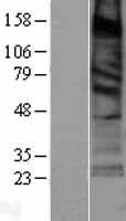 SURF4 Protein - Western validation with an anti-DDK antibody * L: Control HEK293 lysate R: Over-expression lysate