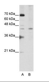 SURF6 Antibody - A: Marker, B: Jurkat Cell Lysate.  This image was taken for the unconjugated form of this product. Other forms have not been tested.