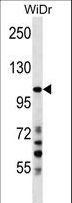 SUSD2 Antibody - SUSD2 Antibody western blot of WiDr cell line lysates (35 ug/lane). The SUSD2 antibody detected the SUSD2 protein (arrow).