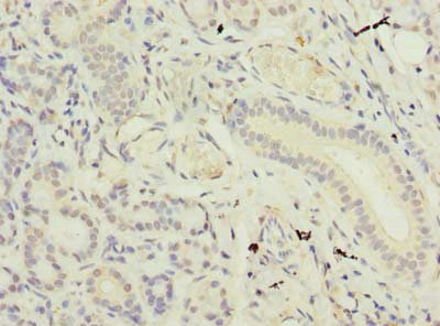 SUSD4 Antibody - Immunohistochemistry of paraffin-embedded human pancreatic tissue using SUSD4 Antibody at dilution of 1:100