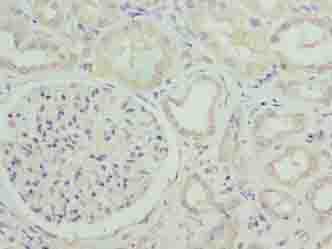 SUSD6 / KIAA0247 Antibody - Immunohistochemistry of paraffin-embedded human kidney tissue using antibody at dilution of 1:100.