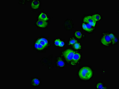 SUSD6 / KIAA0247 Antibody - Immunofluorescent analysis of MCF-7 cells using SUSD6 Antibody at dilution of 1:100 and Alexa Fluor 488-congugated AffiniPure Goat Anti-Rabbit IgG(H+L)