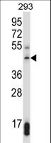 SUV39H1 Antibody - SUV39H1 Antibody western blot of 293 cell line lysates (35 ug/lane). The SUV39H1 antibody detected the SUV39H1 protein (arrow).