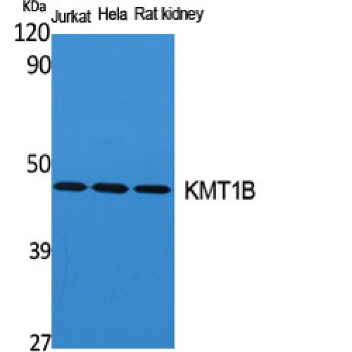 SUV39H2 Antibody - Western blot of KMT1B antibody