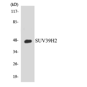 SUV39H2 Antibody - Western blot analysis of the lysates from 293 cells using SUV39H2 antibody.