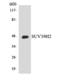 SUV39H2 Antibody - Western blot analysis of the lysates from 293 cells using SUV39H2 antibody.