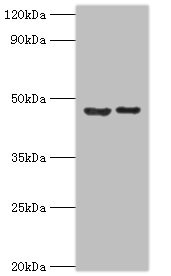 SUV39H2 Antibody - Western blot All lanes: Histone-lysine N-methyltransferase SUV39H2 antibody at 0.32µg/ml Lane 1: HepG2 whole cell lysate Lane 2: Hela whole cell lysate Secondary Goat polyclonal to rabbit IgG at 1/10000 dilution Predicted band size: 47, 40, 27 kDa Observed band size: 47 kDa