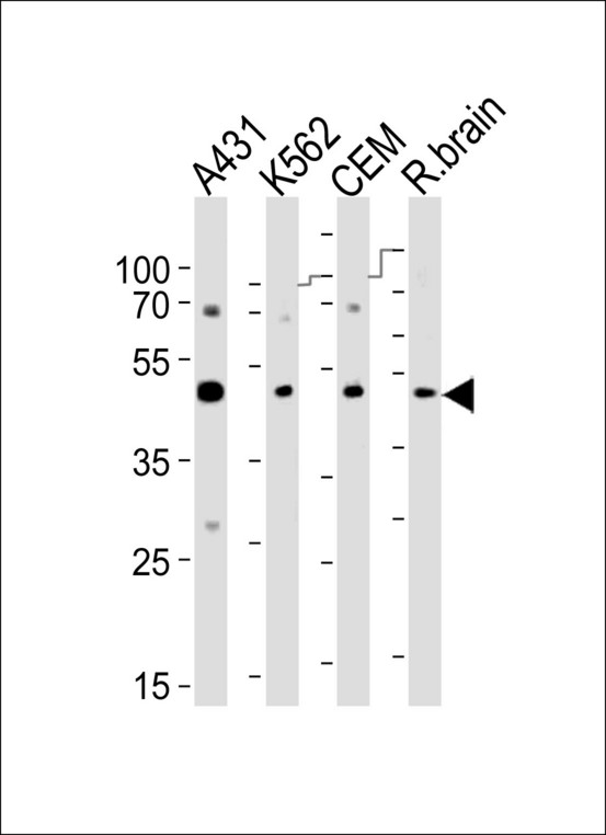 SUV39H2 Antibody - Western blot of lysates from A431, K562, CEM cell line and rat brain tissue lysate(from left to right), using SUV39H2 Antibody (K315). Antibody was diluted at 1:1000 at each lane. A goat anti-rabbit IgG H&L (HRP) at 1:10000 dilution was used as the secondary antibody. Lysates at 35ug per lane.