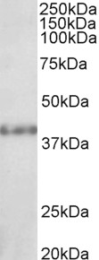 SUV39H2 Antibody - SUV39H2 antibody (1µg/ml) staining of Rat Kidney lysate (35µg protein in RIPA buffer). Detected by chemiluminescence.