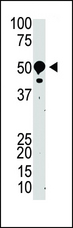 SUV39H2 Antibody - The anti-SUV39H2 antibody is used in Western blot to detect SUV39H2 in mouse kidney tissue lysate.