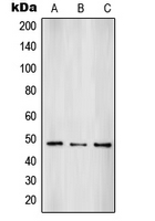 SUV39H2 Antibody - Western blot analysis of SUV39H2 expression in HepG2 (A); A431 (B); HL60 (C) whole cell lysates.