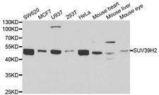 SUV39H2 Antibody - Western blot analysis of extracts of various cell lines, using SUV39H2 antibody.