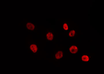 SUV39H2 Antibody - Staining 293T cells by IF/ICC. The samples were fixed with PFA and permeabilized in 0.1% Triton X-100, then blocked in 10% serum for 45 min at 25°C. The primary antibody was diluted at 1:200 and incubated with the sample for 1 hour at 37°C. An Alexa Fluor 594 conjugated goat anti-rabbit IgG (H+L) Ab, diluted at 1/600, was used as the secondary antibody.