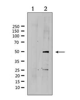 SUV39H2 Antibody - Western blot analysis of extracts of HepG2 cells using SUV39H2 antibody. Lane 1 was treated with the antigen-specific peptide.