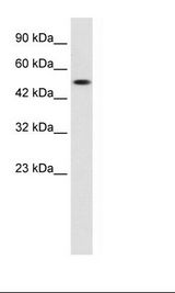 SUV420H1 Antibody - HepG2 Cell Lysate.  This image was taken for the unconjugated form of this product. Other forms have not been tested.