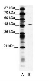 SUV420H1 Antibody - A: Marker, B: Jurkat Cell Lysate.  This image was taken for the unconjugated form of this product. Other forms have not been tested.