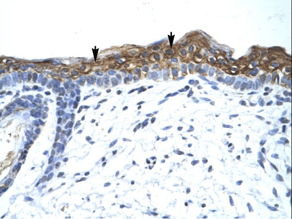 SUV420H1 Antibody - SUV420H1 antibody ARP34567_P050-SUV420H1 (suppressor of variegation 4-20 homolog 1 (Drosophila)) Antibody was used in IHC to stain formalin-fixed, paraffin-embedded human skin.  This image was taken for the unconjugated form of this product. Other forms have not been tested.