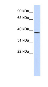 SUV420H1 Antibody - SUV420H1 antibody Western blot of Fetal Lung lysate. This image was taken for the unconjugated form of this product. Other forms have not been tested.