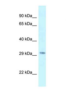 SUV420H1 Antibody - SUV420H1 antibody western blot of Mouse Thymus lysate. Antibody concentration 1 ug/ml.  This image was taken for the unconjugated form of this product. Other forms have not been tested.