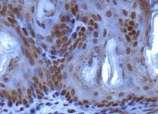 SUV420H1 Antibody - Immunohistochemistry: SUV420h1 Antibody - IHC analysis of SUV420h1 in mouse epidermis using DAB with hematoxylin counterstain.  This image was taken for the unconjugated form of this product. Other forms have not been tested.