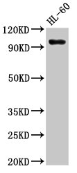 SUV420H1 Antibody - Positive Western Blot detected in HL-60 whole cell lysate. All lanes: KMT5B antibody at 3 µg/ml Secondary Goat polyclonal to rabbit IgG at 1/50000 dilution. Predicted band size: 100, 45, 32 KDa. Observed band size: 100 KDa