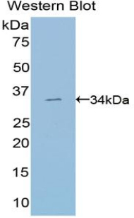SUV420H2 Antibody - Western blot of recombinant SUV420H2.  This image was taken for the unconjugated form of this product. Other forms have not been tested.