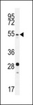 SUV420H2 Antibody - SUV4-20H2 Antibody western blot of mouse stomach tissue lysates (35 ug/lane). The SUV4-20H2 antibody detected the SUV4-20H2 protein (arrow).
