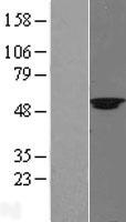SUV420H2 Protein - Western validation with an anti-DDK antibody * L: Control HEK293 lysate R: Over-expression lysate
